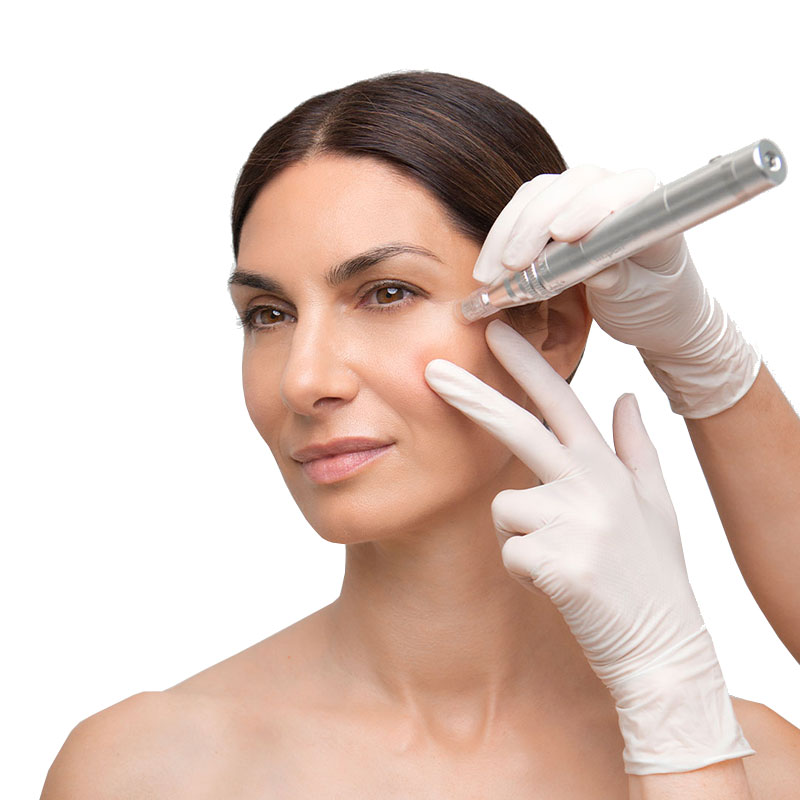 Microneedling Haut-Manufaktur Chemnitz